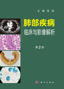 肺部疾病临床与影像解析（第二版）