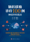 脑转移癌诊疗100例——神经外科观点