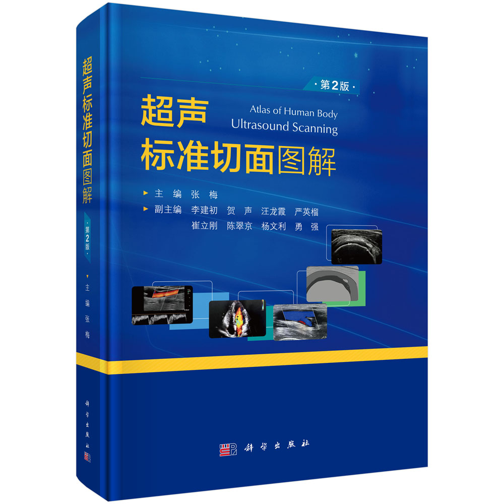 超声标准切面图解（第2版）