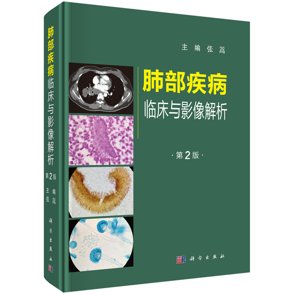 肺部疾病临床与影像解析（第二版）