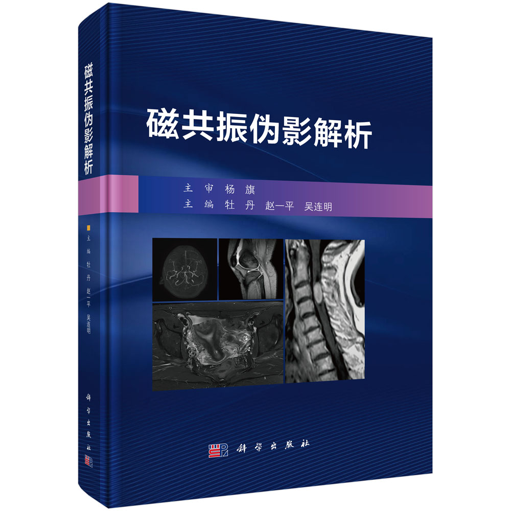 磁共振伪影解析
