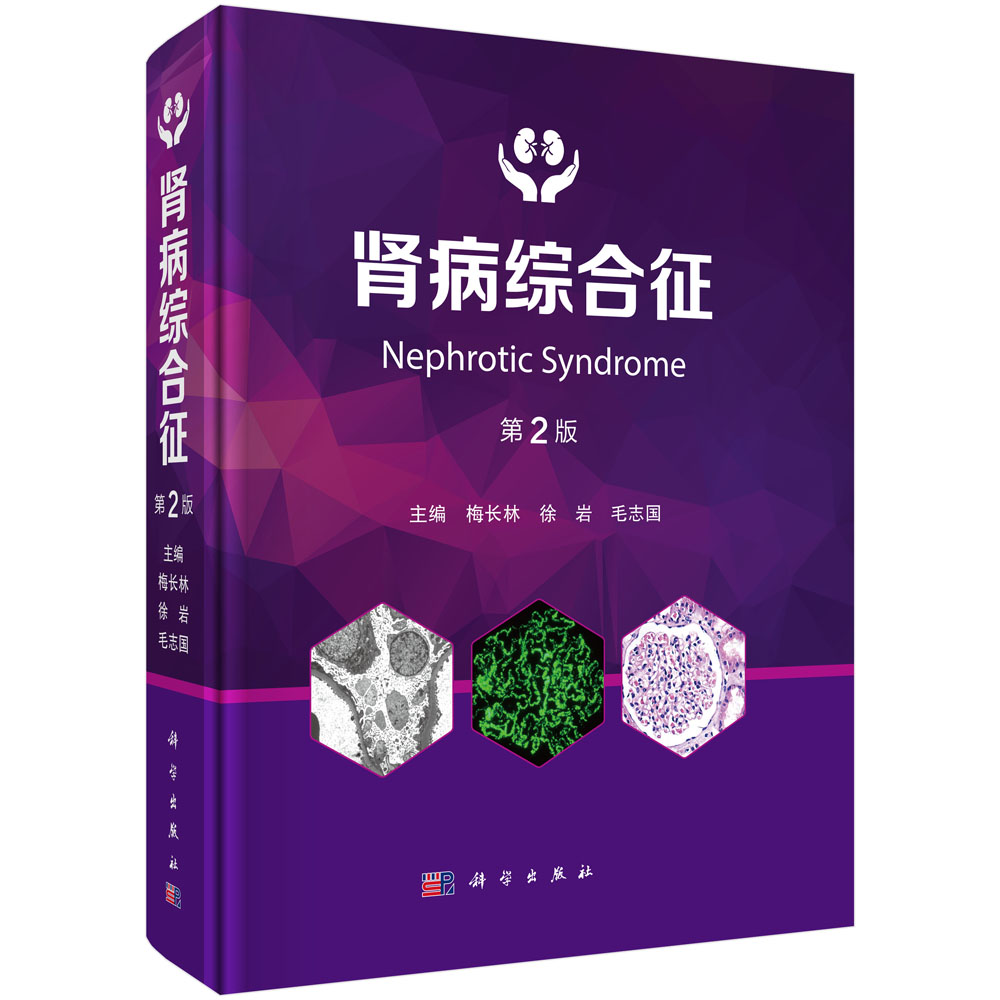 肾病综合征（第2版）