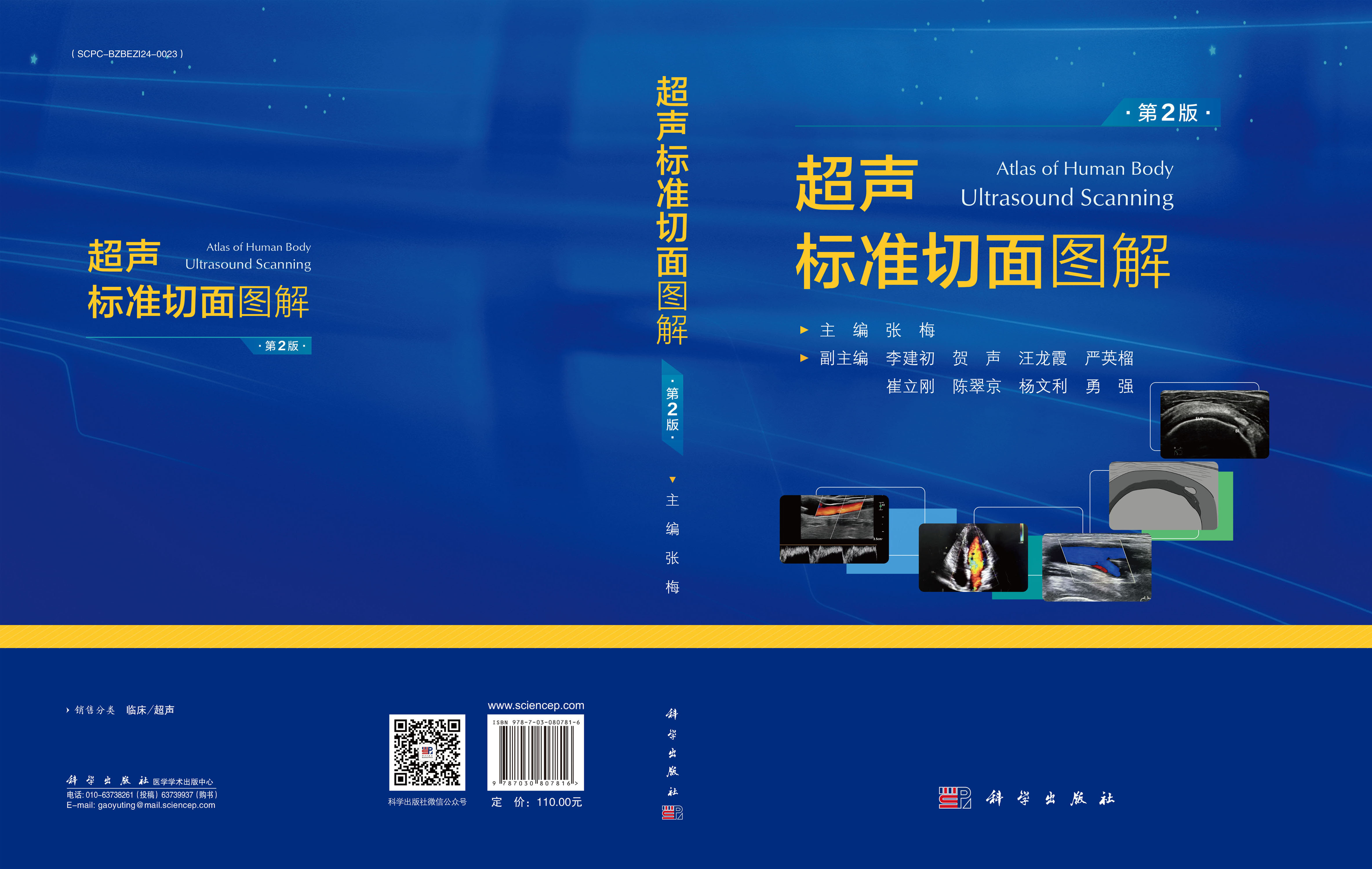 超声标准切面图解（第2版）
