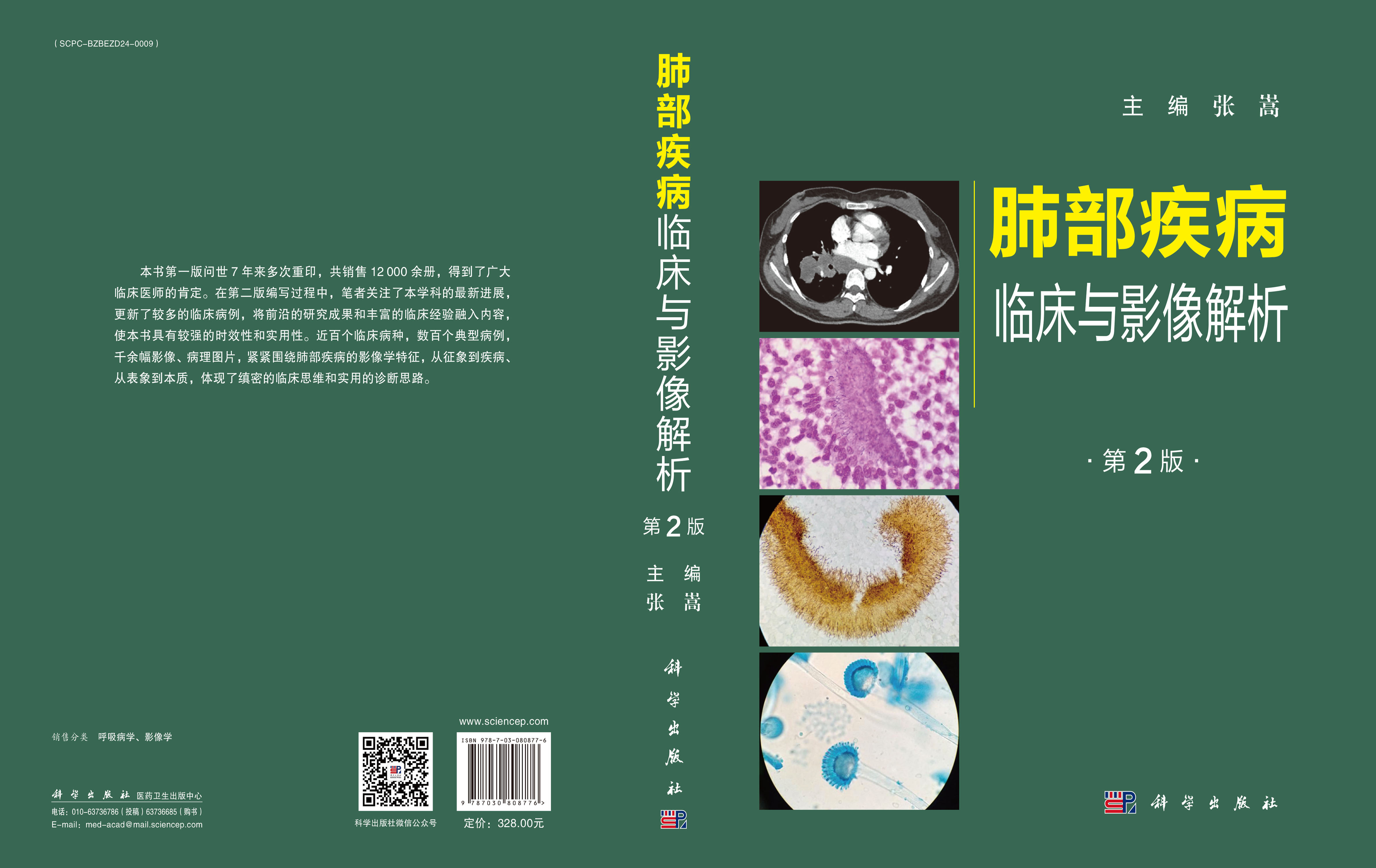 肺部疾病临床与影像解析（第二版）