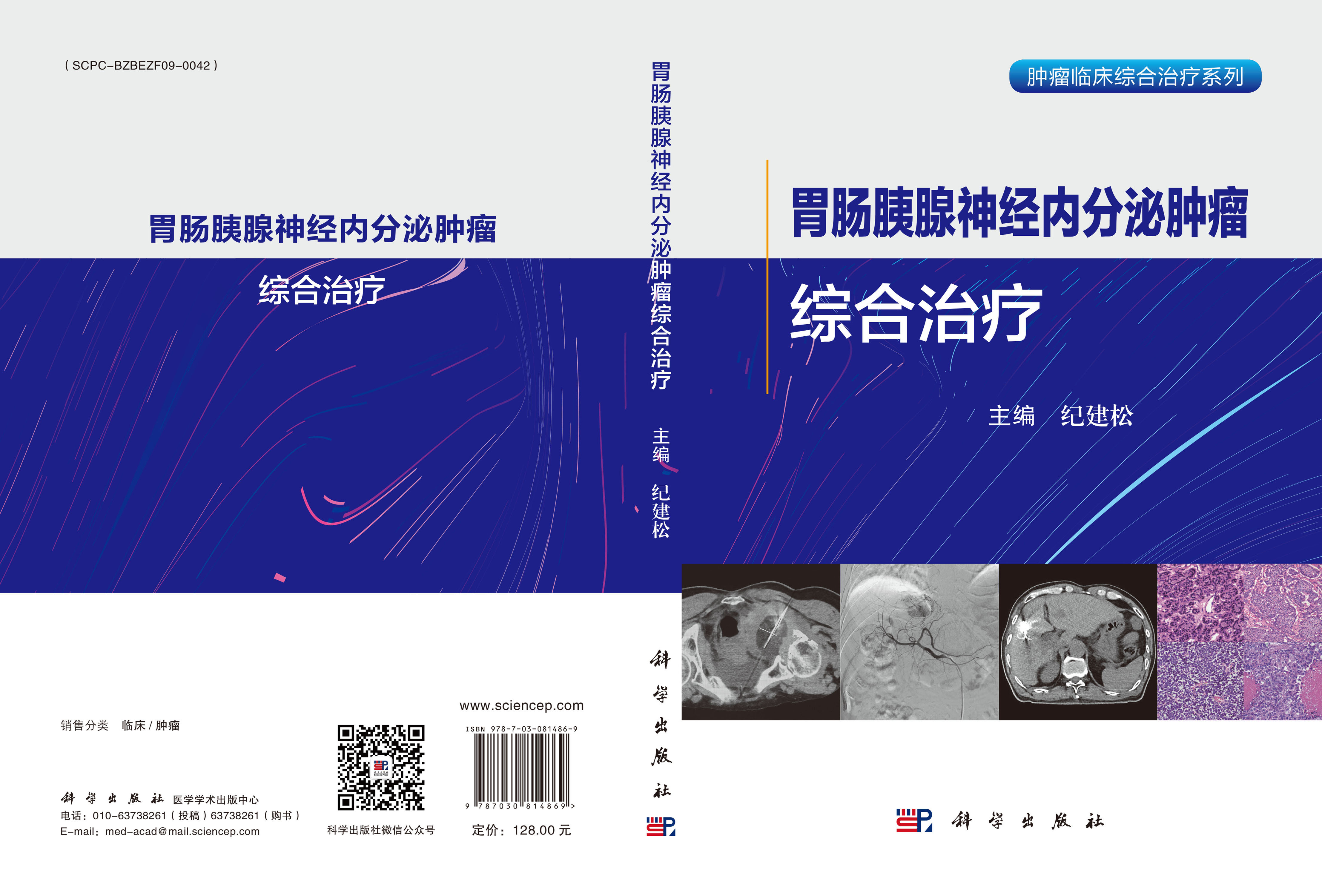胃肠胰腺神经内分泌肿瘤综合治疗