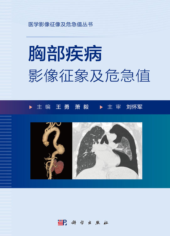 胸部疾病影像征像及危急值