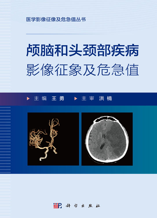 颅脑和头颈部疾病影像征象及危急值