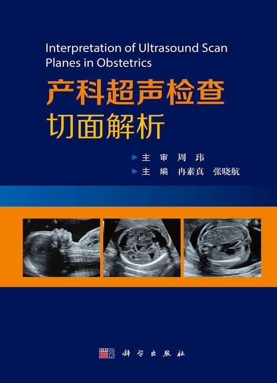产科超声检查切面解析