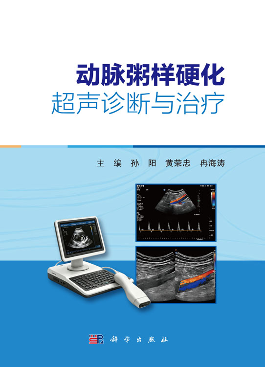 动脉粥样硬化超声诊断与治疗