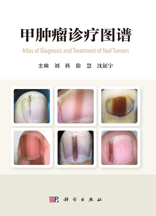 甲肿瘤诊疗图谱