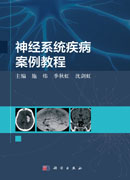 神经系统疾病案例教程