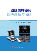 动脉粥样硬化超声诊断与治疗