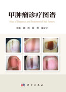 甲肿瘤诊疗图谱