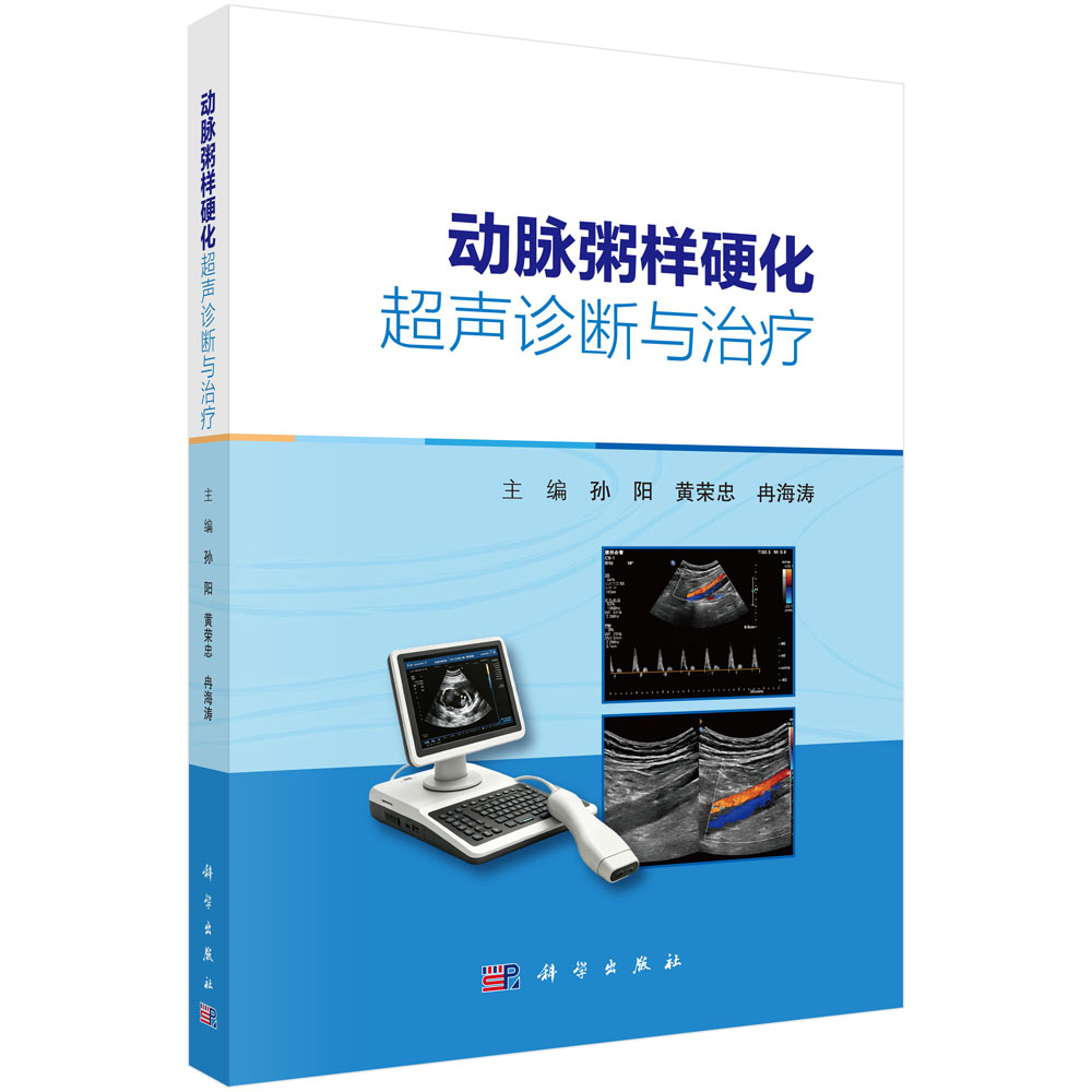 动脉粥样硬化超声诊断与治疗