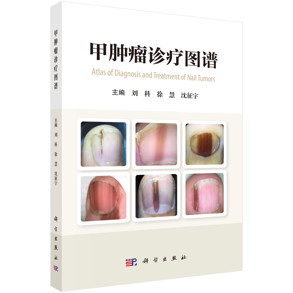 甲肿瘤诊疗图谱