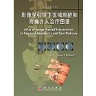 影像学引导下区域麻醉和疼痛介入治疗图谱