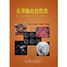 实用脑血管图谱（第二版）