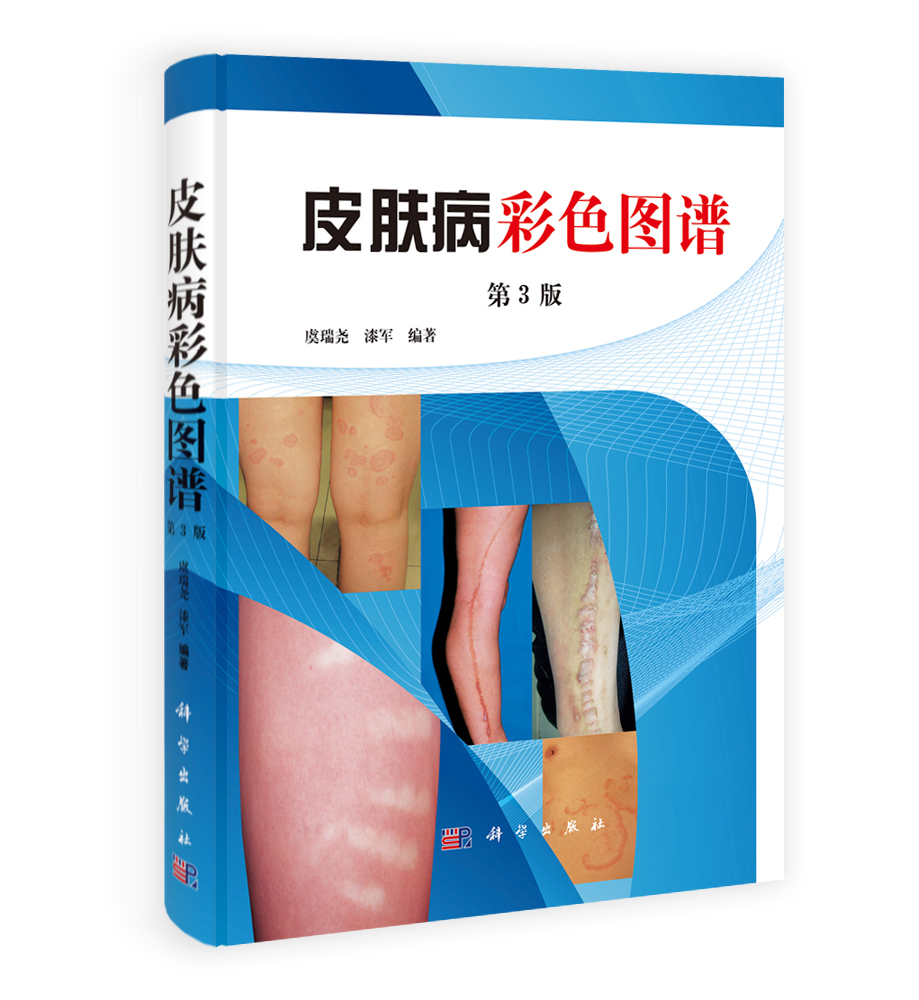 皮肤病彩色图谱（第3版）